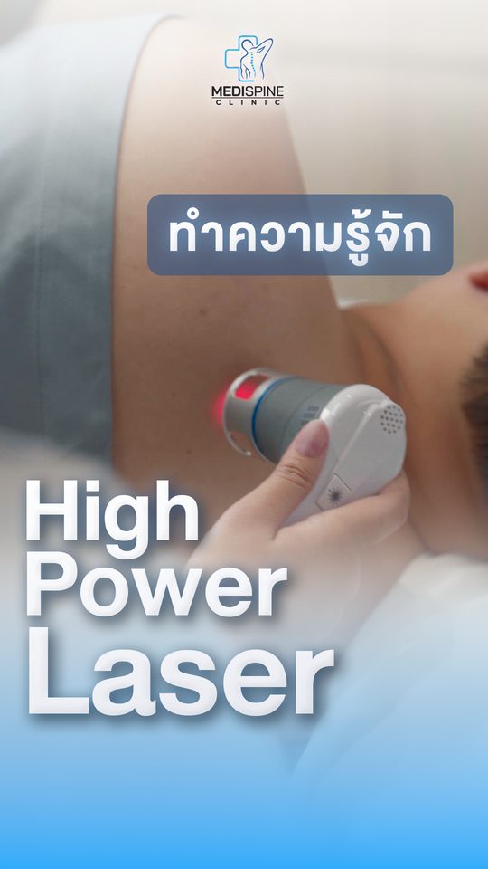 ทำความรู้จัก High Power Laser ตัวช่วยจัดการปวดโดยไม่ต้องผ่าตัด